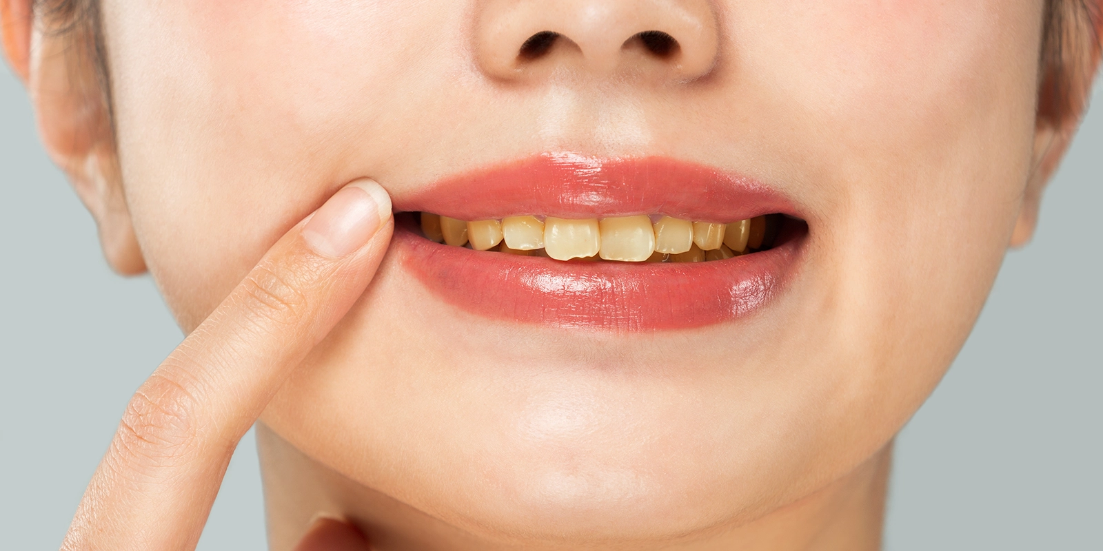 歯の汚れや着色汚れの原因