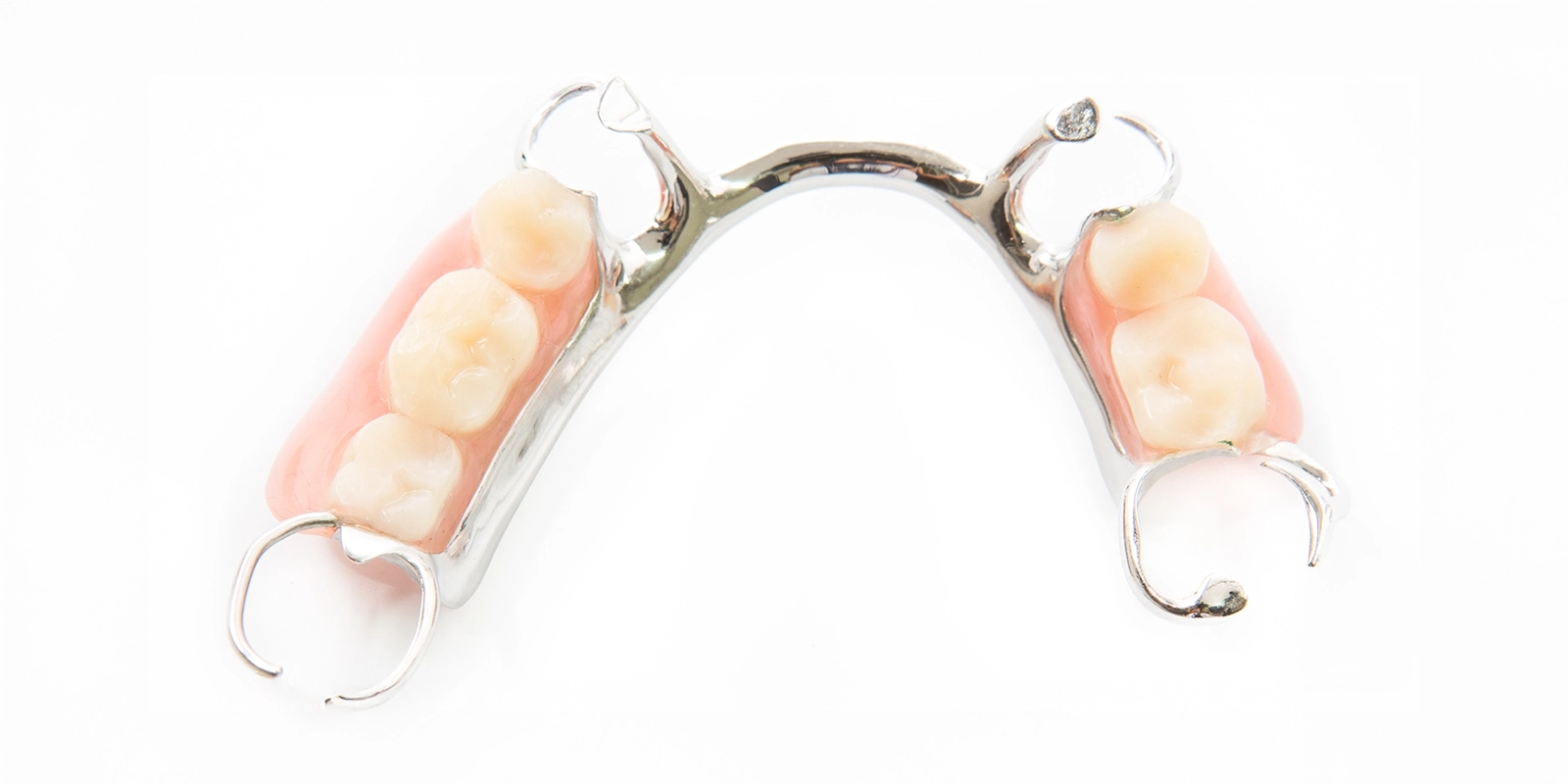 部分入れ歯とは？